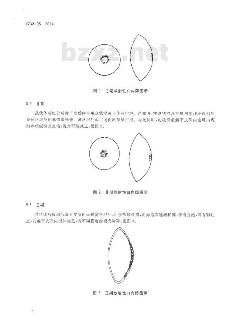 GB/Z 95-2014 职业性放射性白内障的诊断